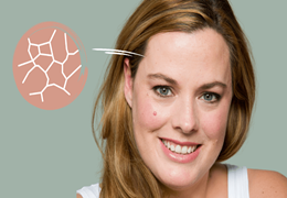De ideale verzorgingsroutine voor de droge huid